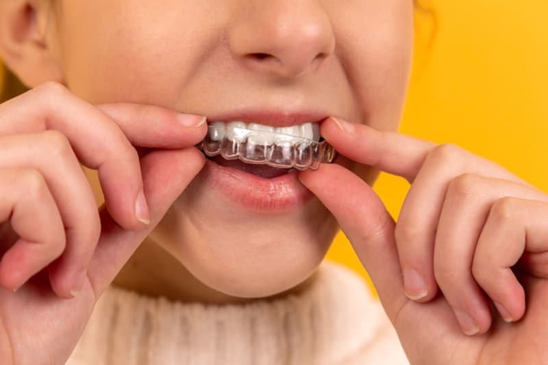 Fixed dental bridge replacing missing teeth anchored to neighboring teeth in Rahim Yar Khan